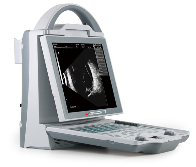 Эхоофтальмограф OFTO-50