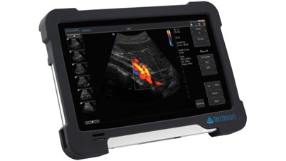 Портативный ультразвуковой аппарат Terason 3200T цена в Киеве